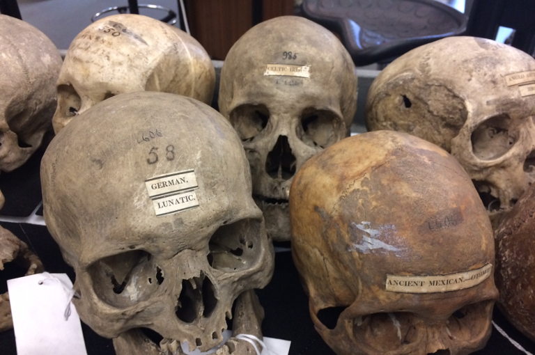 human skulls