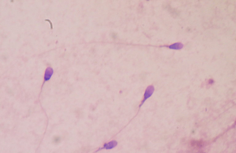 sperm stained for testing
