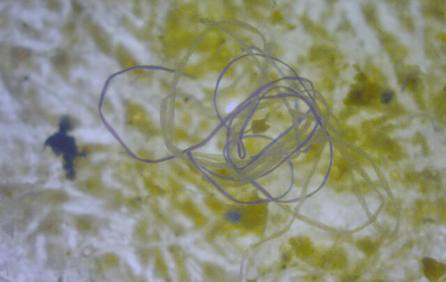 Microplastics in the ocean